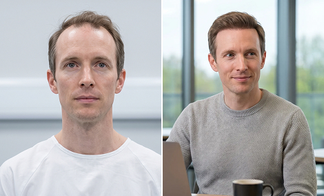 Frontal density hair restoration