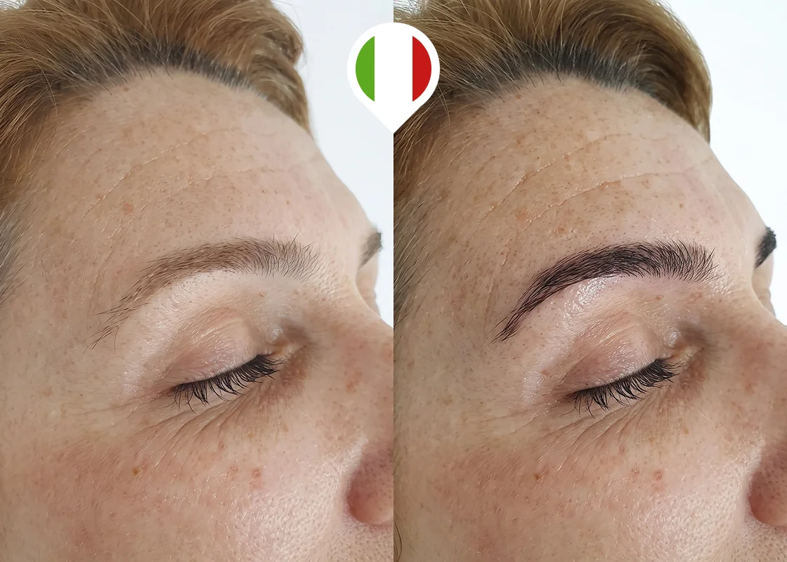 Sparse eyebrow tail and arch restoration